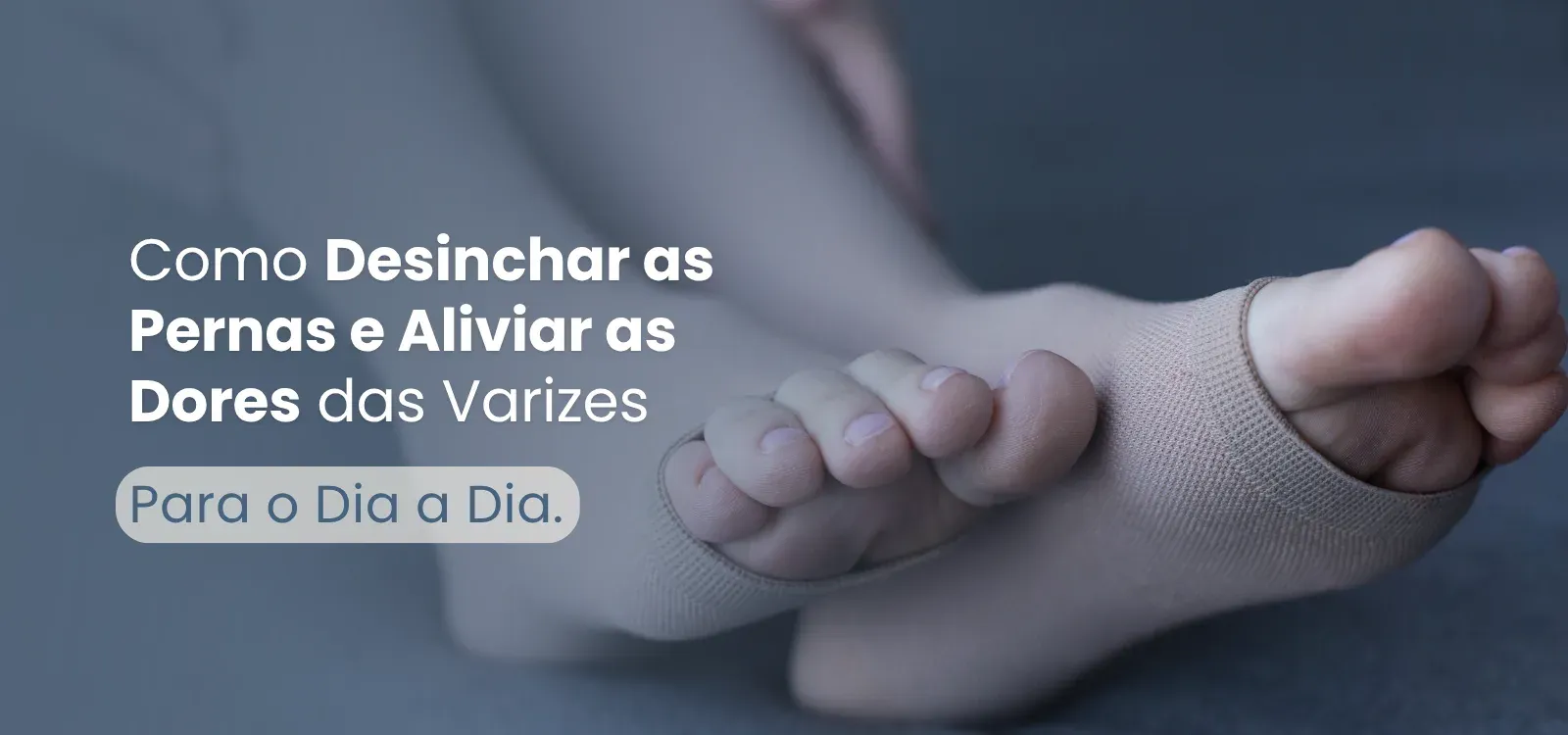 Pernas de uma pessoa em tratamento para varizes.