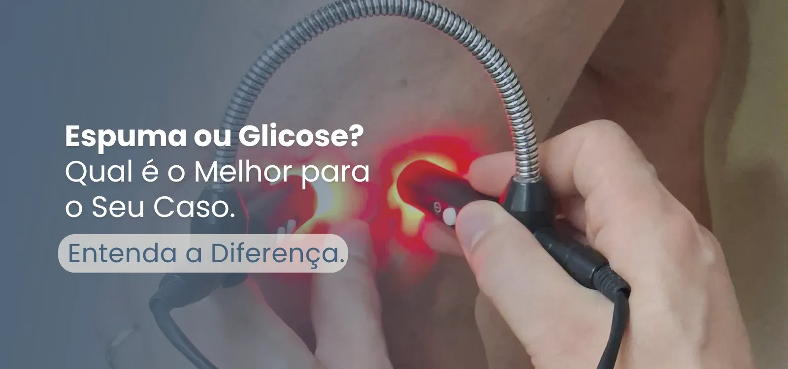 Tratamento vascular para varizes realizado na perna de uma paciente.